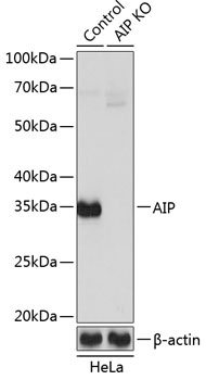 Anti-AIP Antibody [KO Validated] (CAB19969)