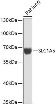 Anti-SLC1A5 Antibody (CAB12676)