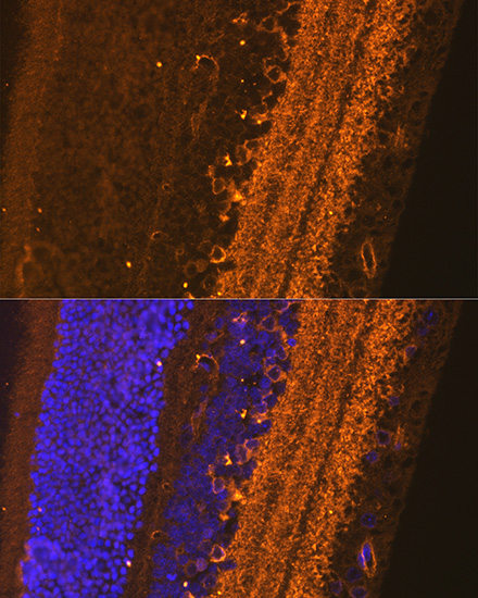 Anti-GAD1 Antibody (CAB2938)