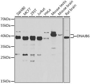 Anti-DNAJB6 Antibody (CAB7052)