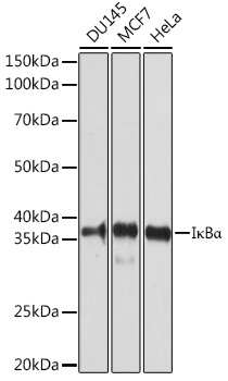 Anti-IkBAlpha Antibody (CAB1187)