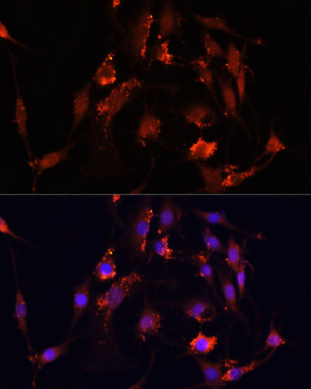 Anti-MOV10 Antibody (CAB3966)