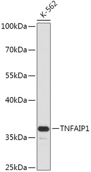 Anti-TNFAIP1 Antibody (CAB17543)