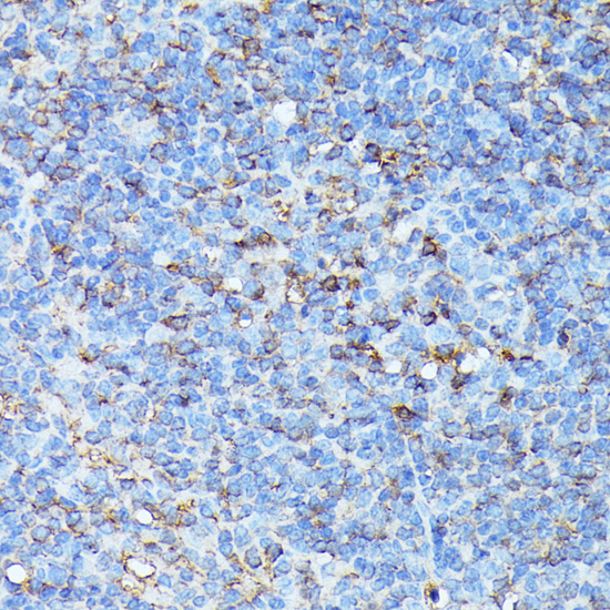 Anti-CXCR1 Antibody (CAB16386)