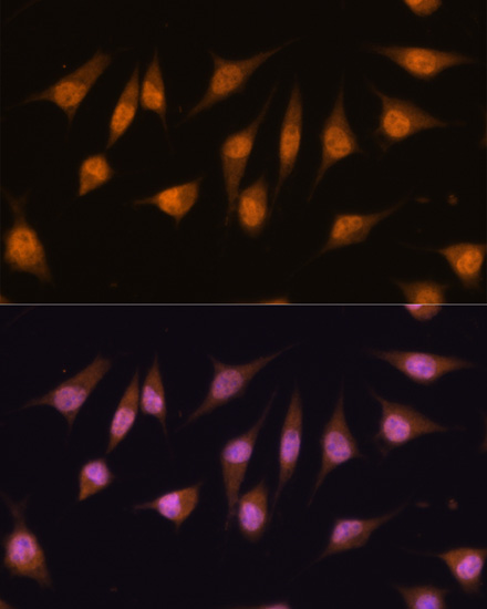 Anti-MYOD1 Antibody (CAB0671)