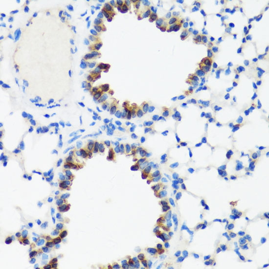 Anti-GM130 Antibody (CAB16248)