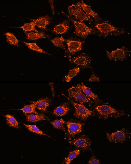 Anti-PASK Polyclonal Antibody (CAB8995)