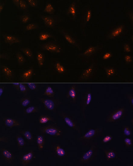 Anti-LLPH Antibody (CAB15534)