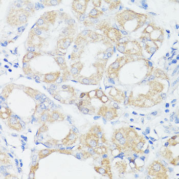 Anti-PRR11 Antibody (CAB15599)