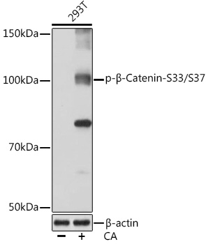 Anti-Phospho-Beta-Catenin-S33/S37 Antibody (CABP0979)