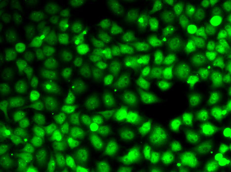 Anti-Cyclin E2 Antibody (CAB14086)