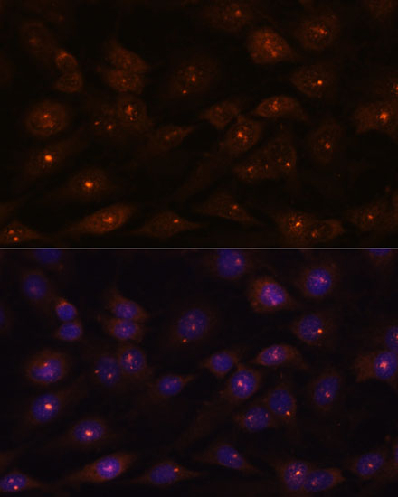 Anti-RNASEH2A Antibody (CAB15132)