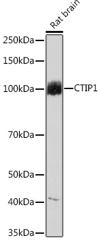 Anti-CTIP1 Antibody (CAB9231)