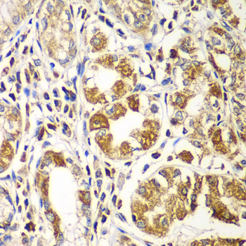 Anti-RAC1 Antibody (CAB7720)