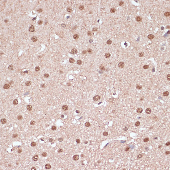 Anti-ITCH Antibody [KO Validated] (CAB15612)