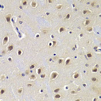 Anti-CDKN1B/p27KIP1 Antibody [KO Validated] (CAB0290)