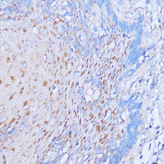 Anti-NME6 Antibody (CAB14388)