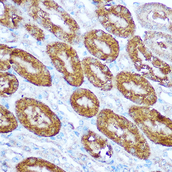 Anti-CASP1 Antibody [KO Validated] (CAB18646)