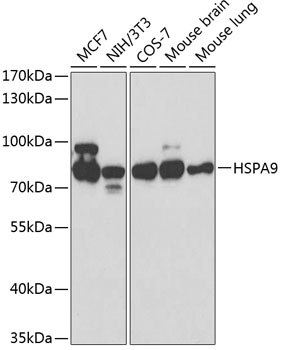 Anti-HSPA9 Antibody (CAB0558)