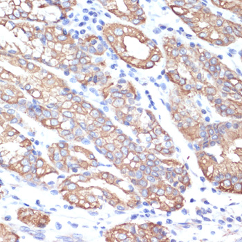 Anti-Cytokeratin-18 Antibody (CAB1022)