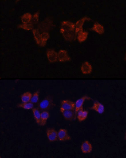 Anti-LAMP1 Antibody (CAB2582)