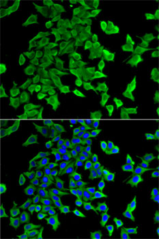 Anti-ITGA2B Antibody (CAB5680)