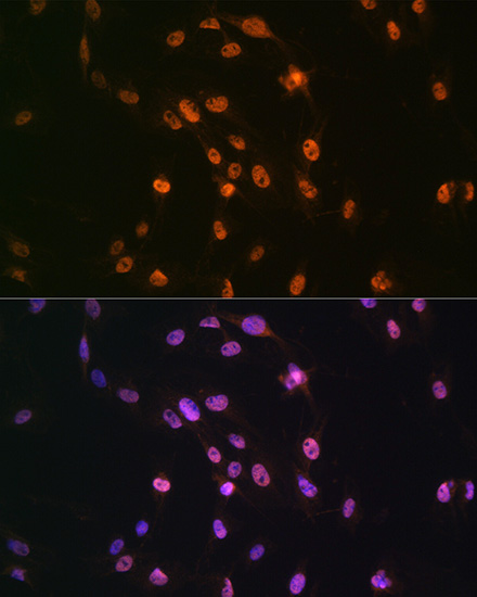 Anti-TARDBP Antibody (CAB13405)