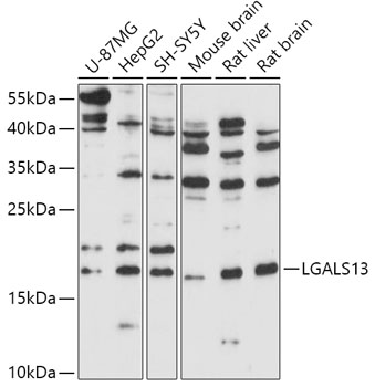 Anti-LGALS13 Antibody (CAB17691)