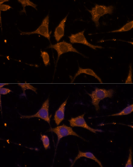 Anti-RPL27 Antibody (CAB13044)