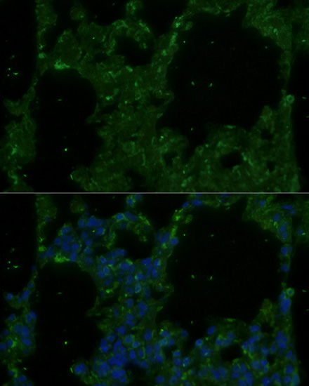 Anti-TREM2 Antibody (CAB10482)