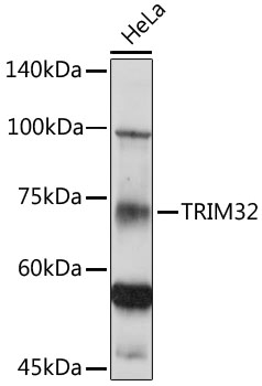 Anti-TRIM32 Antibody (CAB7079)