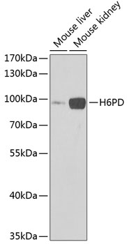 Anti-H6PD Antibody (CAB6440)