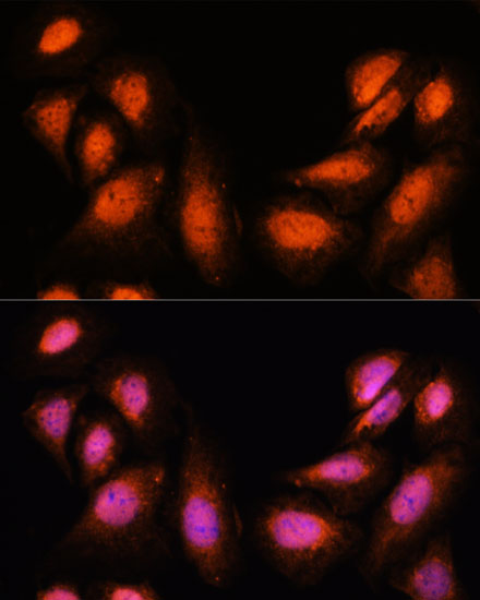 Anti-SUPT6H Antibody (CAB16434)