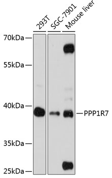 Anti-PPP1R7 Antibody (CAB13041)