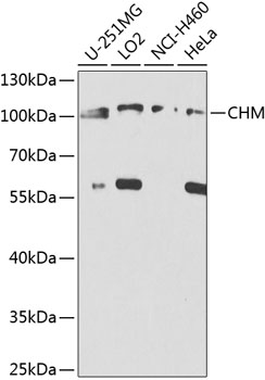 Anti-CHM Polyclonal Antibody (CAB8345)