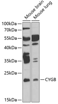 Anti-CYGB Antibody (CAB6488)