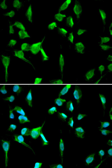 Anti-TOPBP1 Antibody (CAB5781)