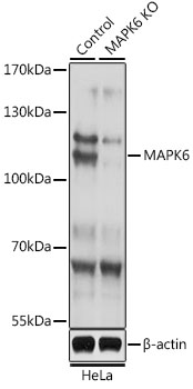 Anti-MAPK6 Antibody [KO Validated] (CAB15304)