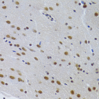 Anti-PPP1R8 Antibody (CAB6701)