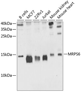 Anti-MRPS6 Polyclonal Antibody (CAB9884)