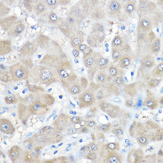 Anti-GAMT Antibody (CAB6597)