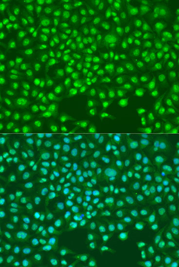 Anti-SKP2 Antibody (CAB0842)