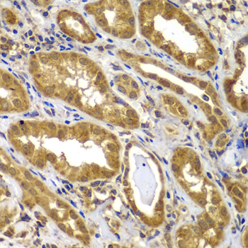 Anti-MT1-MMP Antibody (CAB2549)