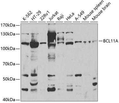 Anti-BCL11A Antibody (CAB5445)