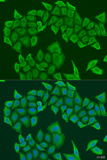 Anti-HAUS8 Antibody (CAB7847)