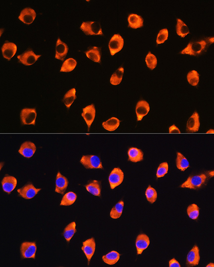 Anti-KIF21A Antibody (CAB16548)