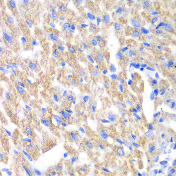 Anti-CREB3 Antibody (CAB13579)