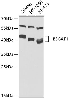 Anti-B3GAT1 Polyclonal Antibody (CAB9871)