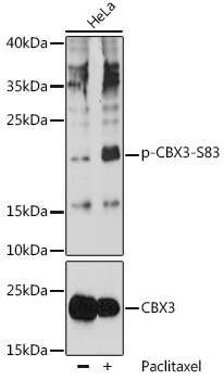 Anti-Phospho-CBX3-S83 pAb (CABP0801)