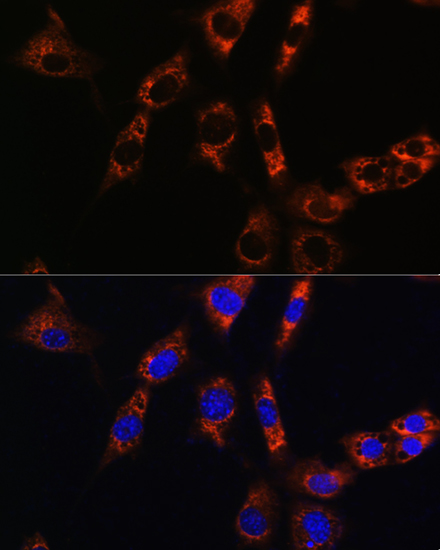 Anti-Aquaporin-8 Polyclonal Antibody (CAB8539)